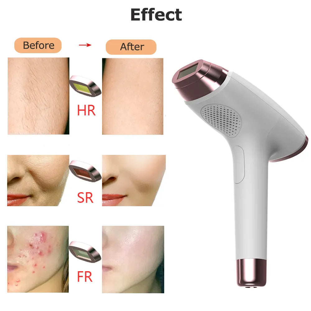 Laser Epilator Painless IPL Hair Removal for Women Body Bikini Legs Arms Laser Hair Remover 999999 Flashes Permanent Depilator - Digital Edges | Online Electronics Store